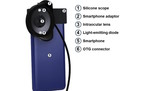 Android telefon otkriva bolesti oka Android telefon otkriva bolesti oka