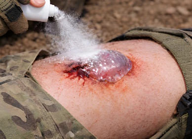 Sprej zaustavlja krvarenje na bojišnici u sekundi Sprej zaustavlja krvarenje na bojišnici u sekundi